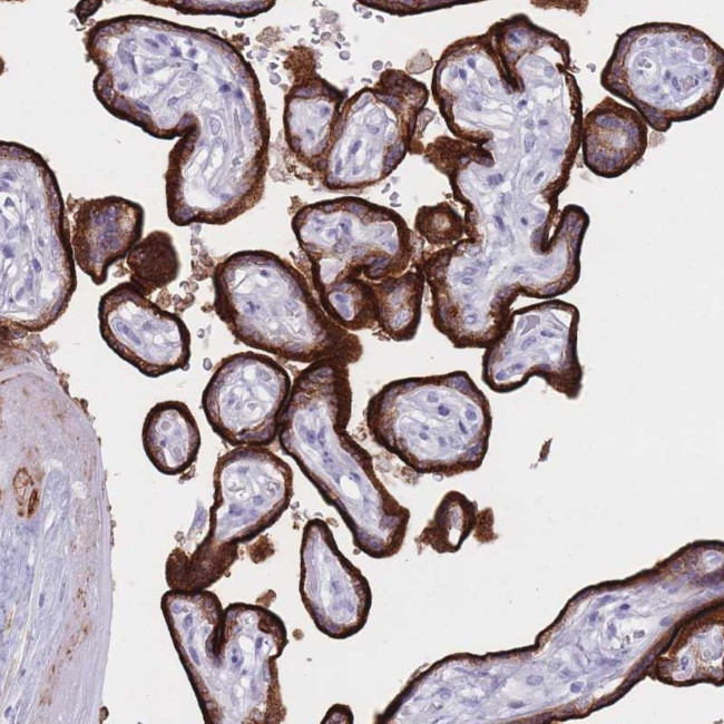 ST3GAL5 Antibody in Immunohistochemistry (Paraffin) (IHC (P))