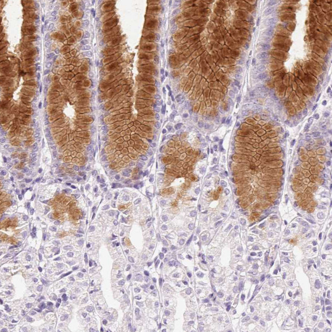 MUC5AC Antibody in Immunohistochemistry (Paraffin) (IHC (P))