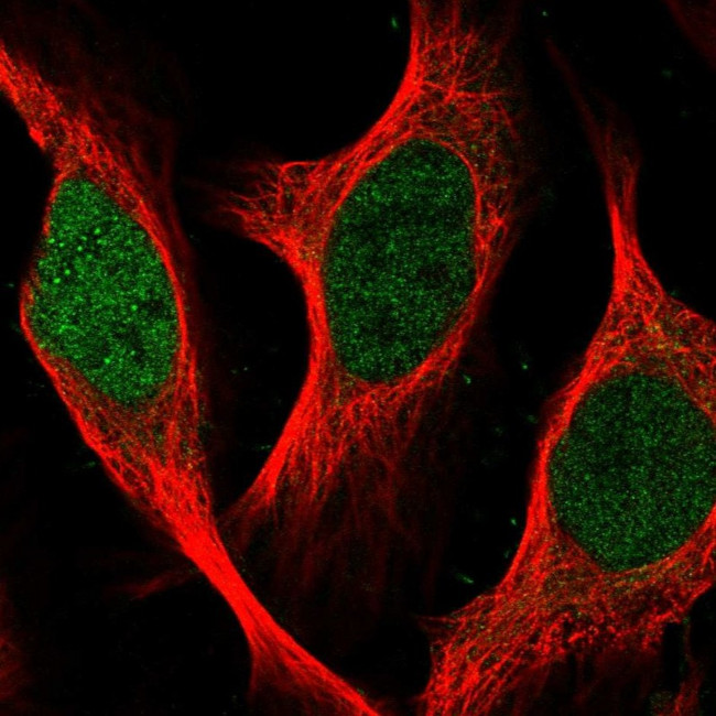 SGOL2 Antibody in Immunocytochemistry (ICC/IF)