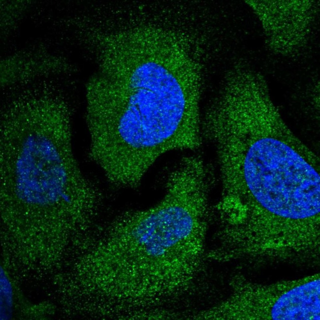 eIF2 beta Antibody in Immunocytochemistry (ICC/IF)