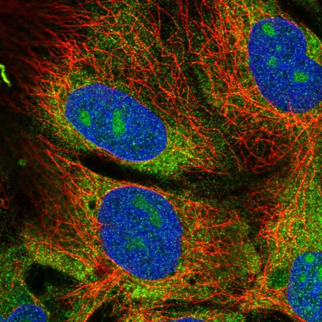 eIF2 beta Antibody in Immunocytochemistry (ICC/IF)