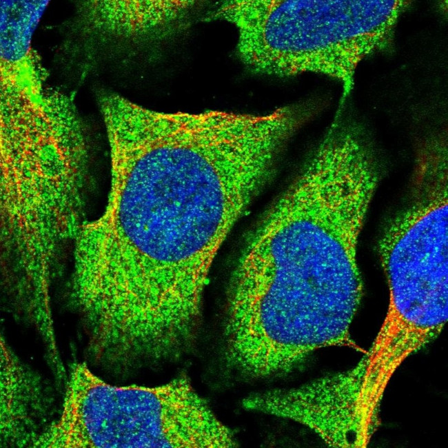 MVD Antibody in Immunocytochemistry (ICC/IF)