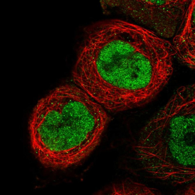 RNaseH2B Antibody in Immunocytochemistry (ICC/IF)