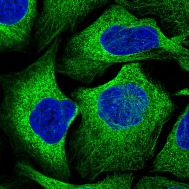 GYS1 Antibody in Immunocytochemistry (ICC/IF)