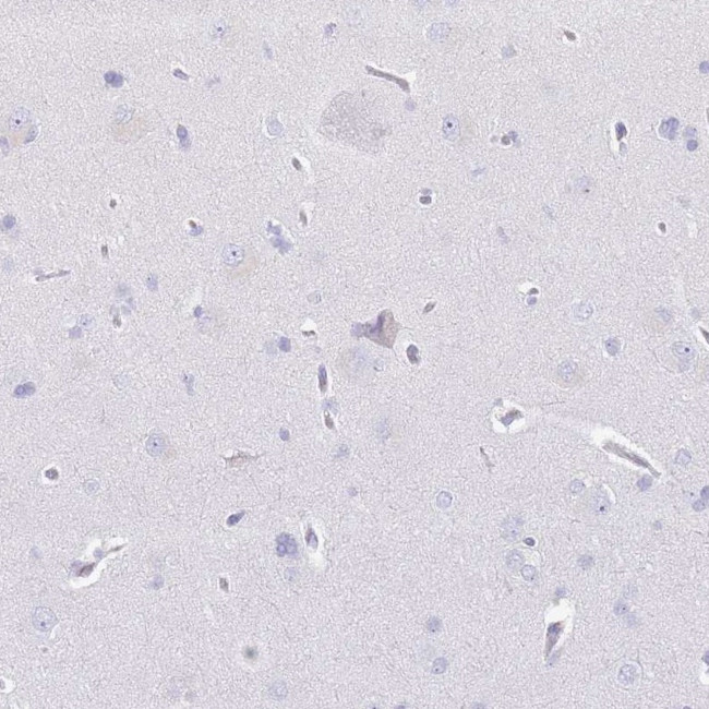 CD177 Antibody in Immunohistochemistry (Paraffin) (IHC (P))