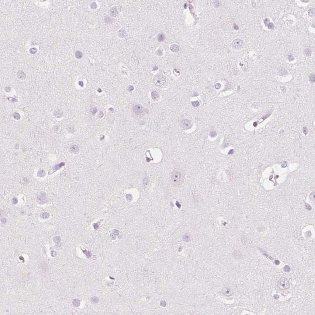 EHHADH Antibody in Immunohistochemistry (Paraffin) (IHC (P))