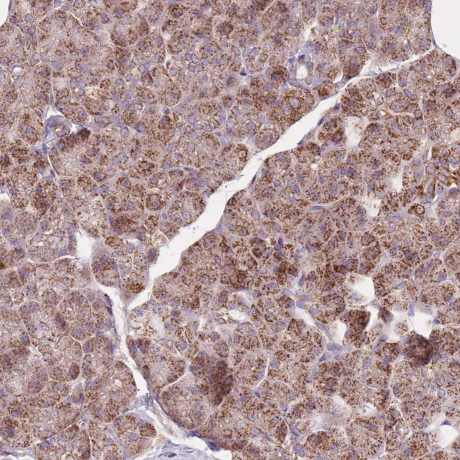 NDUFA9 Antibody in Immunohistochemistry (Paraffin) (IHC (P))