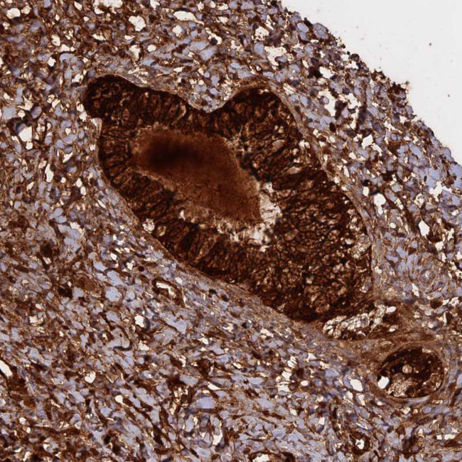 WFDC2 Antibody in Immunohistochemistry (Paraffin) (IHC (P))