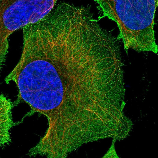 PLD1 Antibody in Immunocytochemistry (ICC/IF)