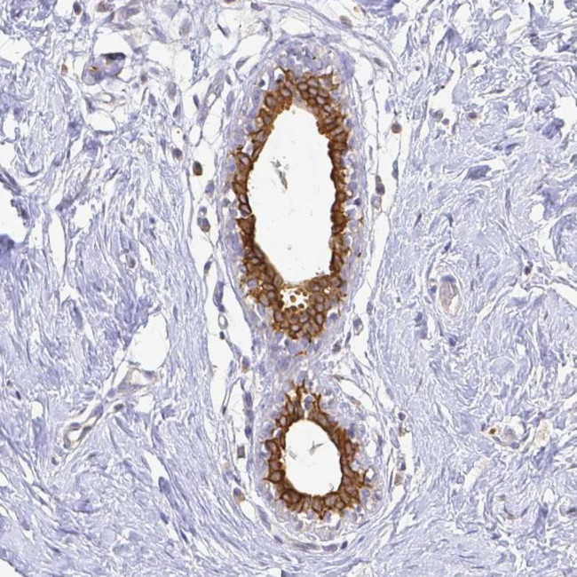 Calmyrin Antibody in Immunohistochemistry (Paraffin) (IHC (P))