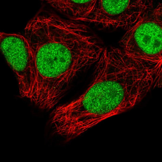 SNRPC Antibody in Immunocytochemistry (ICC/IF)