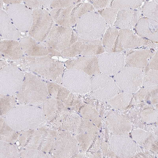 GALNS Antibody in Immunohistochemistry (Paraffin) (IHC (P))