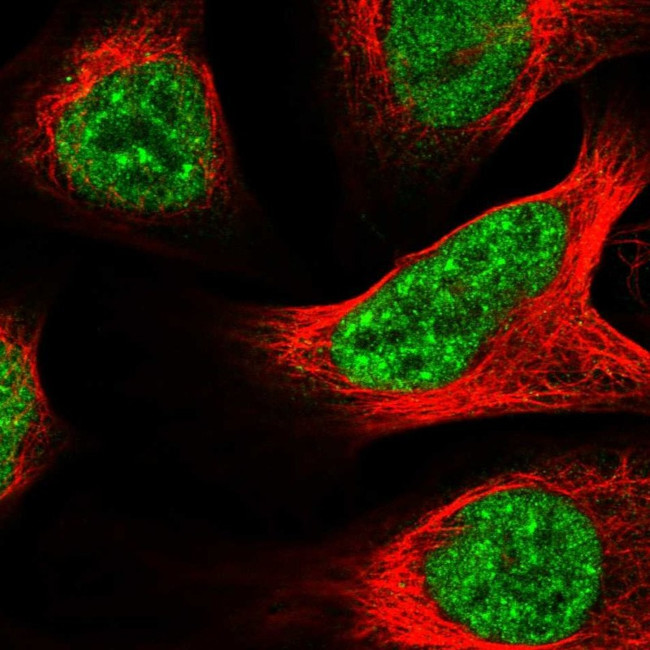 BRD2 Antibody in Immunocytochemistry (ICC/IF)