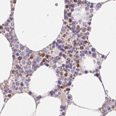 PADI4 Antibody in Immunohistochemistry (Paraffin) (IHC (P))