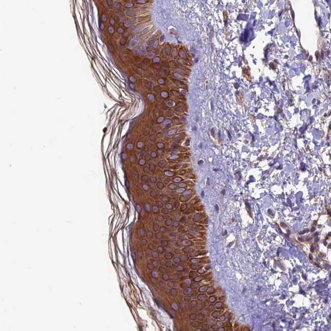 VPS16 Antibody in Immunohistochemistry (Paraffin) (IHC (P))