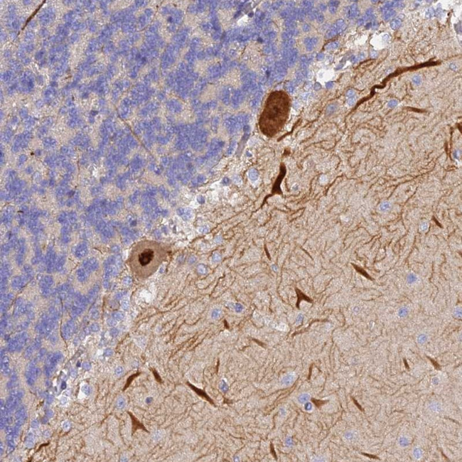 BERP Antibody in Immunohistochemistry (Paraffin) (IHC (P))