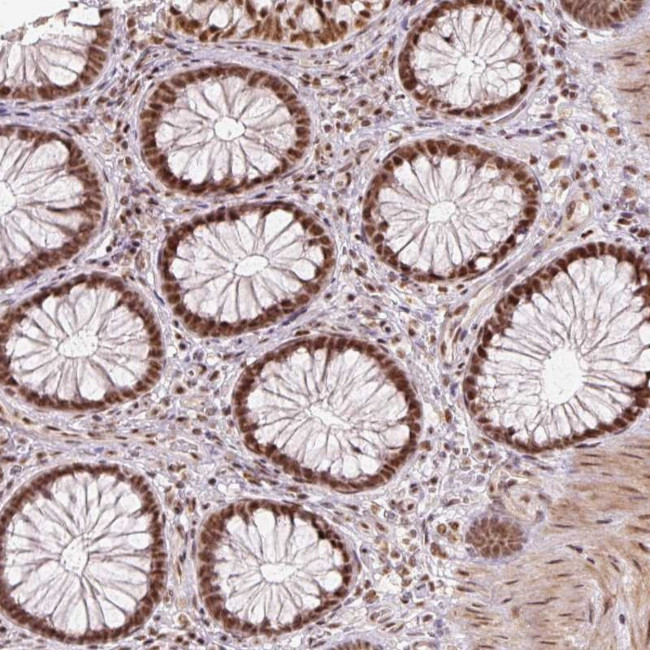 U2AF2 Antibody in Immunohistochemistry (Paraffin) (IHC (P))