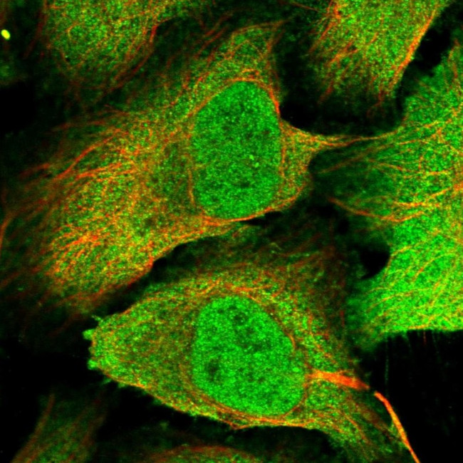 PPP4C Antibody in Immunocytochemistry (ICC/IF)