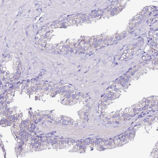 MYBPC3 Antibody in Immunohistochemistry (Paraffin) (IHC (P))