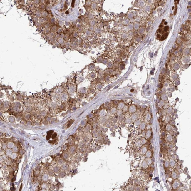 CCS Antibody in Immunohistochemistry (Paraffin) (IHC (P))