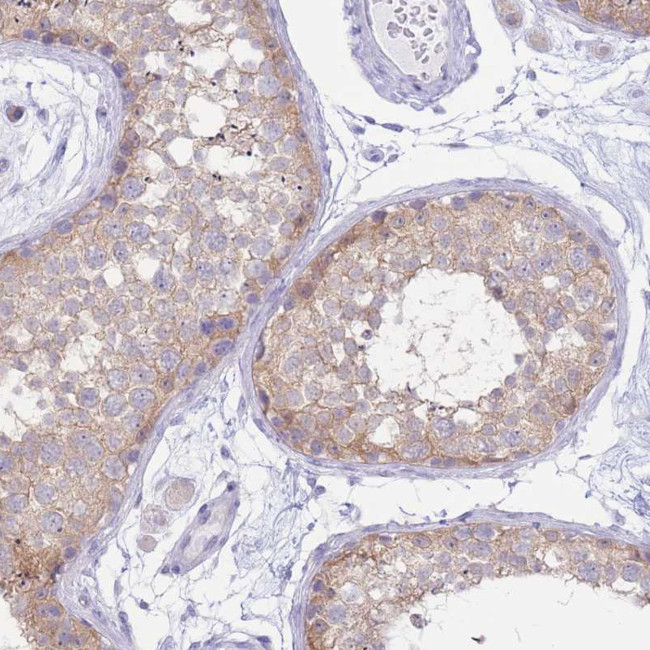 FAH Antibody in Immunohistochemistry (Paraffin) (IHC (P))