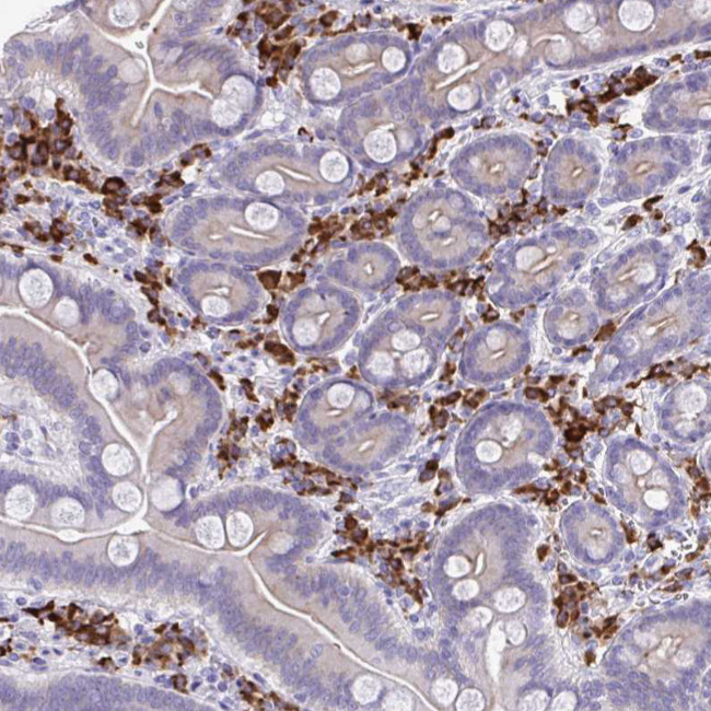 J Chain Antibody in Immunohistochemistry (Paraffin) (IHC (P))