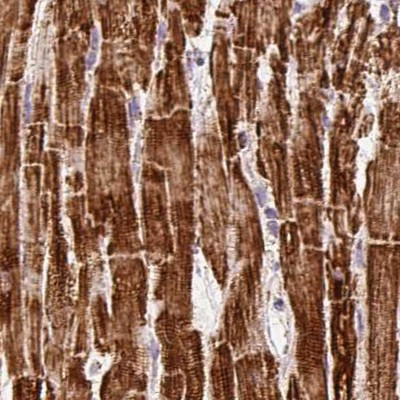 ATP5A1 Antibody in Immunohistochemistry (Paraffin) (IHC (P))