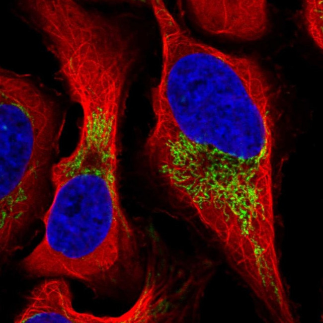 FDXR Antibody in Immunocytochemistry (ICC/IF)