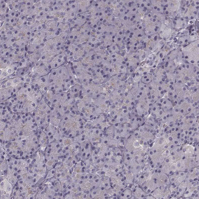 PKC epsilon Antibody in Immunohistochemistry (Paraffin) (IHC (P))