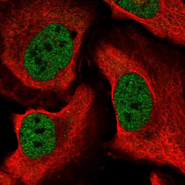 CUGBP1 Antibody in Immunocytochemistry (ICC/IF)