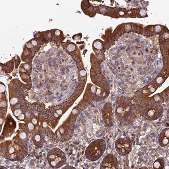 PEX19 Antibody in Immunohistochemistry (Paraffin) (IHC (P))