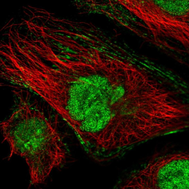 Cardiac Troponin C Antibody in Immunocytochemistry (ICC/IF)