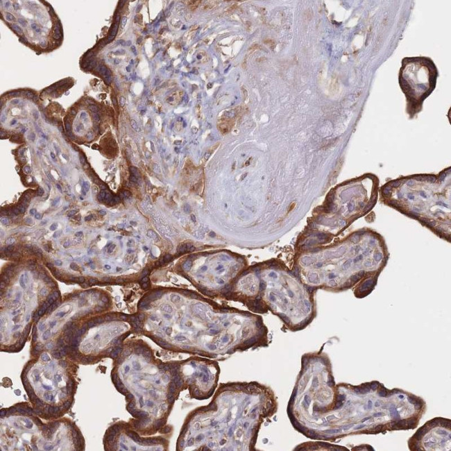 FVT1 Antibody in Immunohistochemistry (Paraffin) (IHC (P))