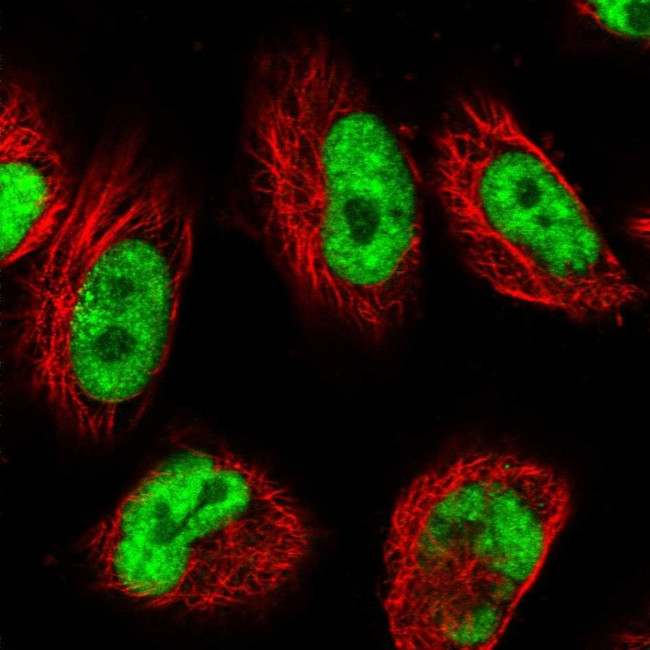 USP22 Antibody in Immunocytochemistry (ICC/IF)