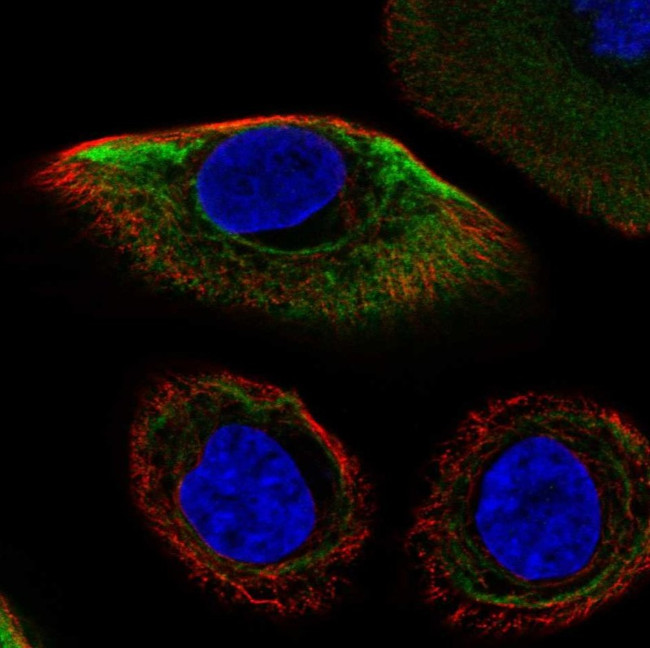 Cytokeratin 17 Antibody in Immunocytochemistry (ICC/IF)