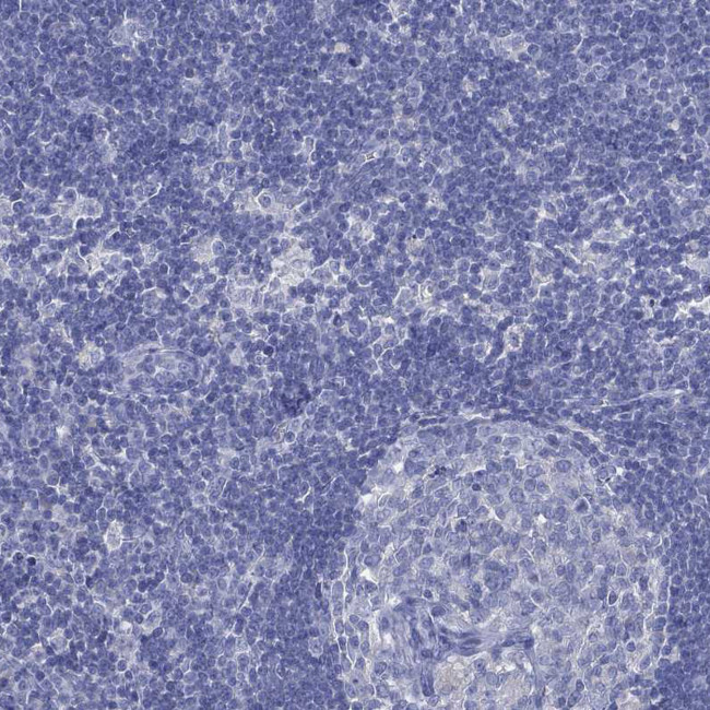 CYP2D6 Antibody in Immunohistochemistry (Paraffin) (IHC (P))