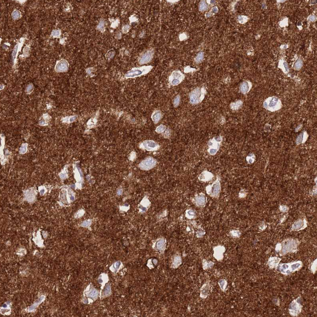 ATP1A3 Antibody in Immunohistochemistry (Paraffin) (IHC (P))