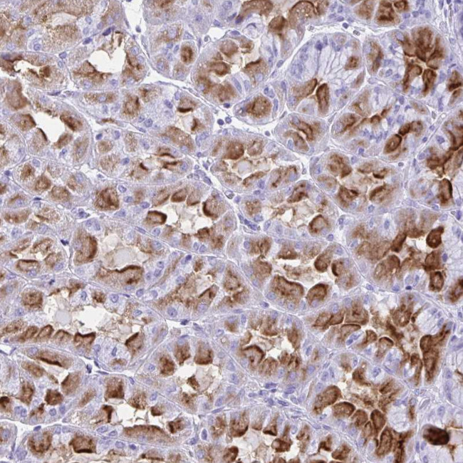 ATP4B Antibody in Immunohistochemistry (Paraffin) (IHC (P))