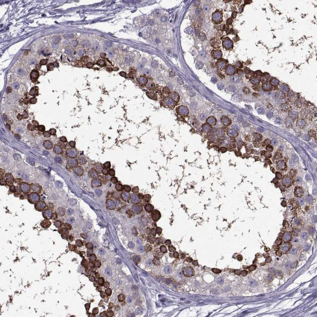 PABPC1 Antibody in Immunohistochemistry (Paraffin) (IHC (P))