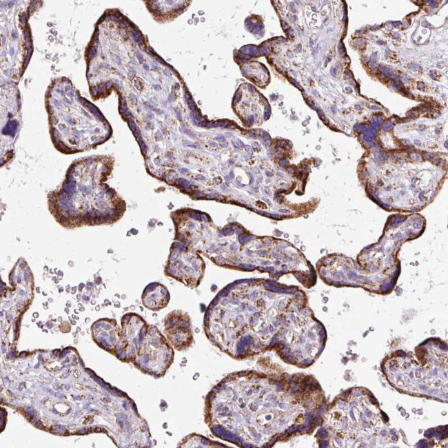 NF1 Antibody in Immunohistochemistry (Paraffin) (IHC (P))