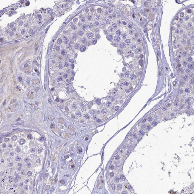 Nova-2 Antibody in Immunohistochemistry (Paraffin) (IHC (P))