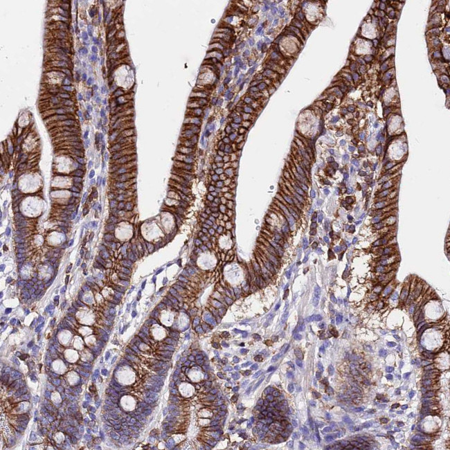 CRP2 Antibody in Immunohistochemistry (Paraffin) (IHC (P))