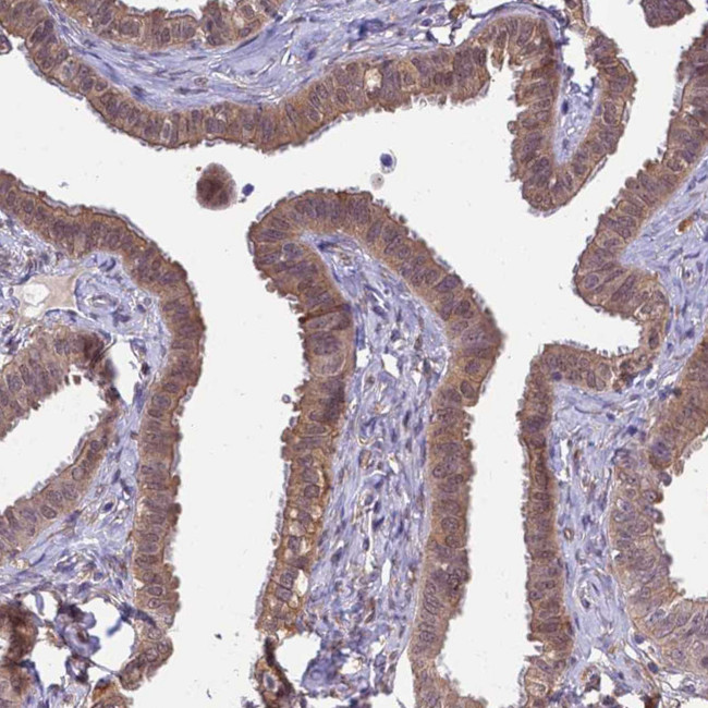 NPEPPS Antibody in Immunohistochemistry (Paraffin) (IHC (P))