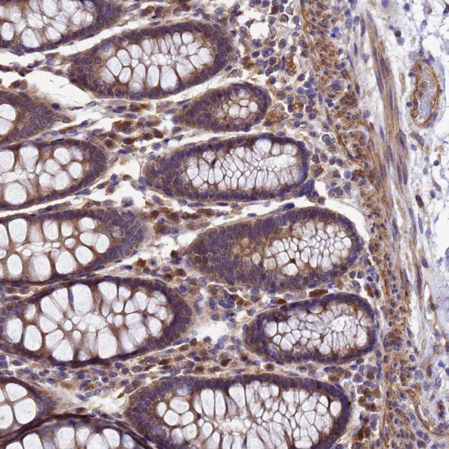 DUSP23 Antibody in Immunohistochemistry (Paraffin) (IHC (P))