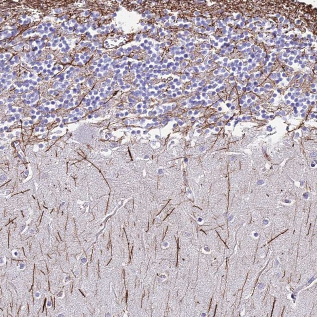 DLX1 Antibody in Immunohistochemistry (Paraffin) (IHC (P))