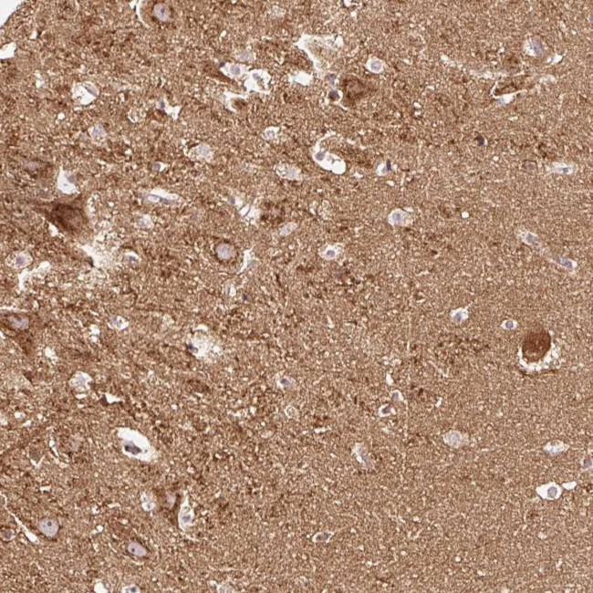 SNAP alpha Antibody in Immunohistochemistry (Paraffin) (IHC (P))