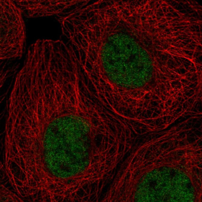 RPA70 Antibody in Immunocytochemistry (ICC/IF)