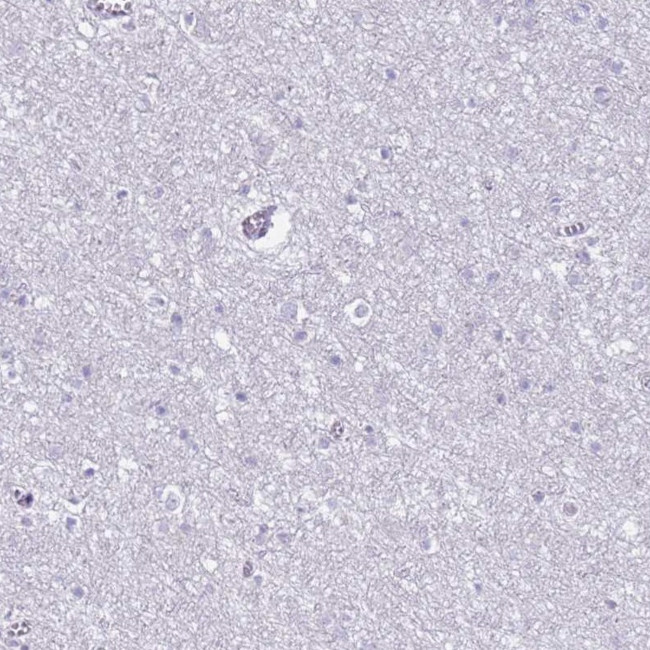 CD177 Antibody in Immunohistochemistry (Paraffin) (IHC (P))