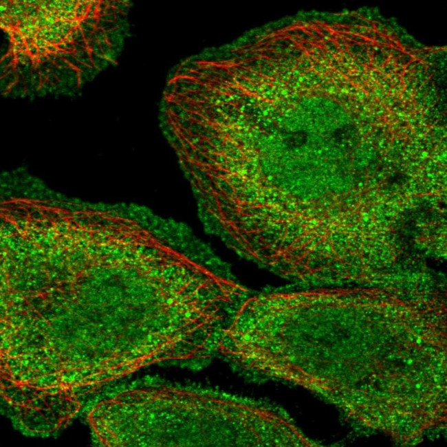 PP1 alpha Antibody in Immunocytochemistry (ICC/IF)