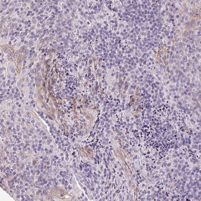 Desmoglein 3 Antibody in Immunohistochemistry (Paraffin) (IHC (P))